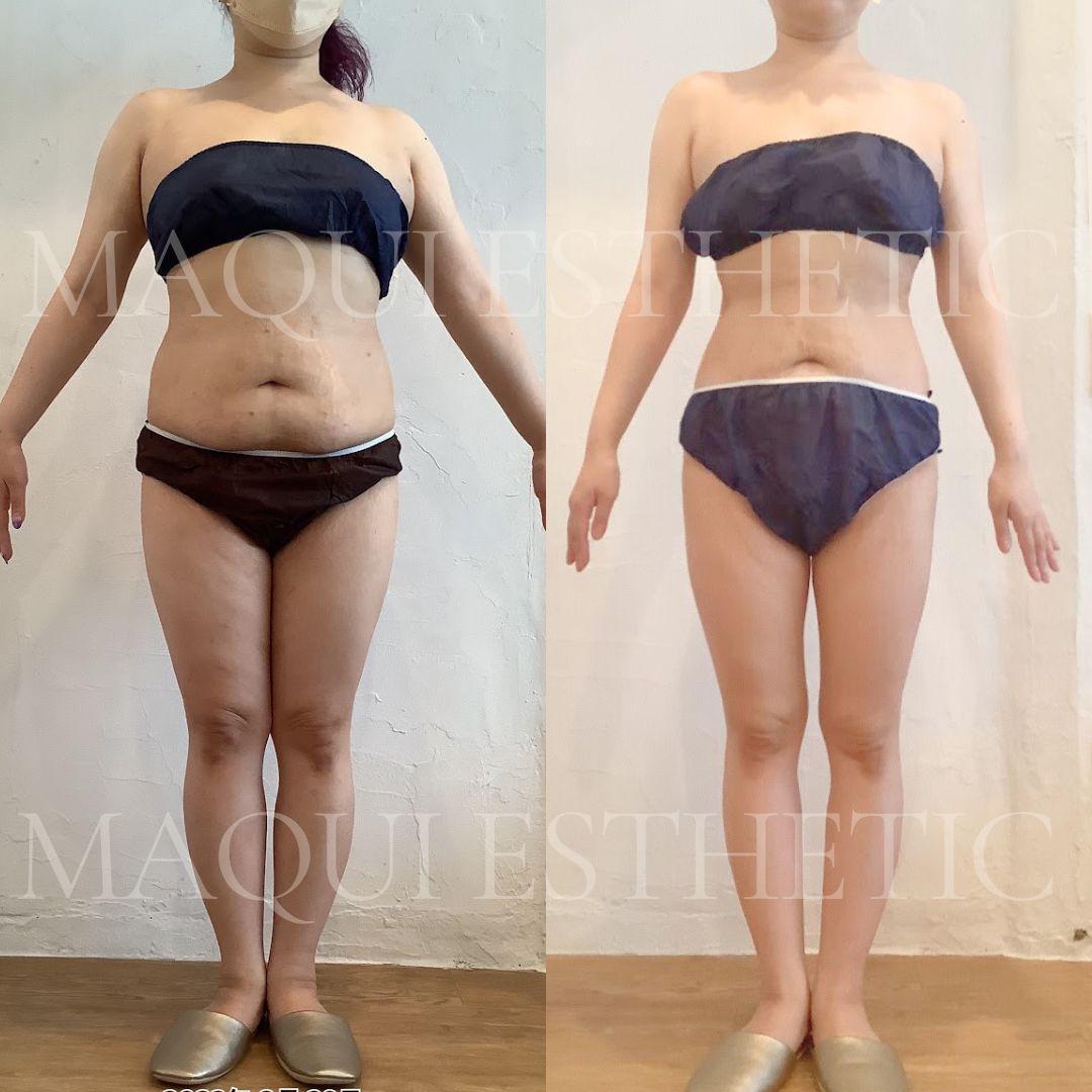 MAQUI ESTHETIC🌈 マクイエステティック　新宿エステサロン