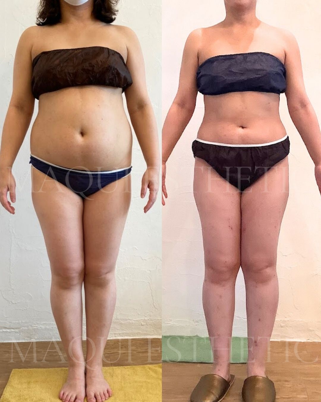 MAQUI ESTHETIC🌈 マクイエステティック　新宿エステサロン